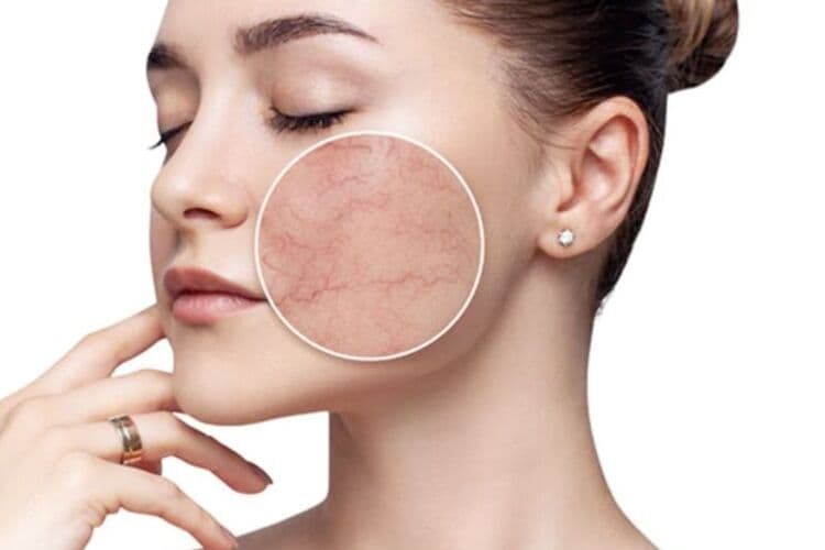 K Vitamini ve Göz Altı Morlukları: Karanlık Halkalara Karşı Doğal Çözümün Gücü